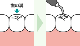 拡大イメージ