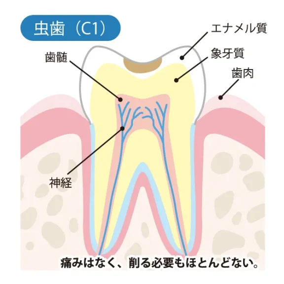 拡大イメージ