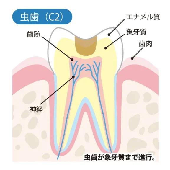 拡大イメージ