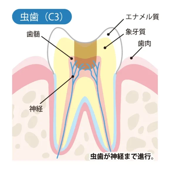 拡大イメージ