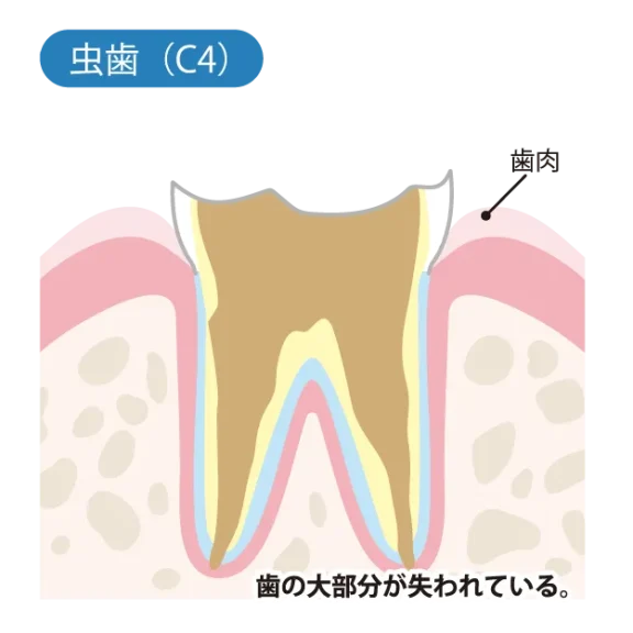 拡大イメージ